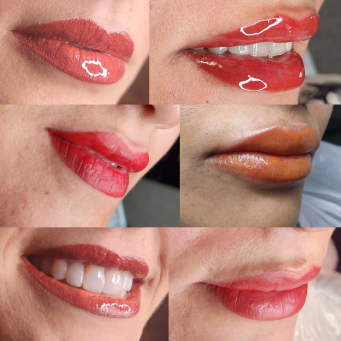 کانتور لب در نورث یورک