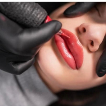 لیپ بلاش در ونکوور