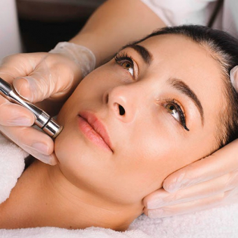 میکرونیدلینگ - نیومارکت