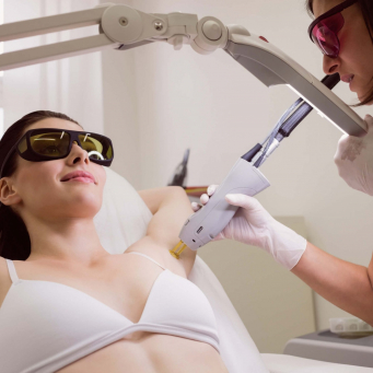 لیزر موهای زائد در ونکوور
