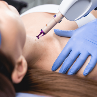 حذف لک های گردن و صورت در ونکوور