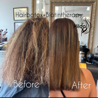 بوتاکس و بیوتین مو در ونکوور