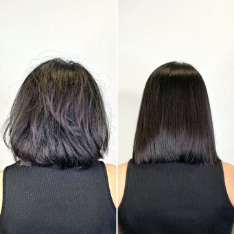 بوتاکس و بیوتین مو در ونکوور