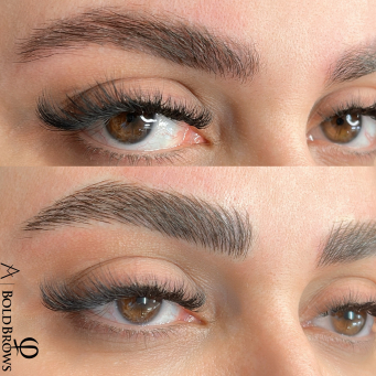 میکروبلیدینگ ابرو در ونکوور