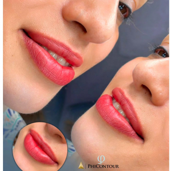 لیپ بلاش در ونکوور