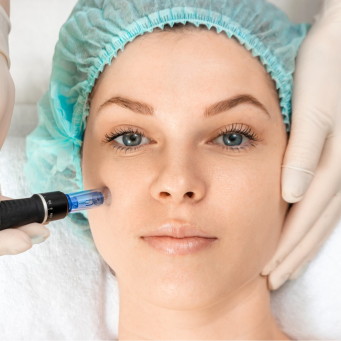 میکرونیدلینگ در ریچموندهیل