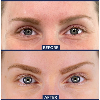 Eyebrow, eyelash & lip