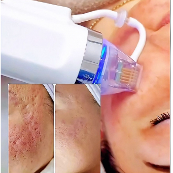 Laser and Skin Clinic