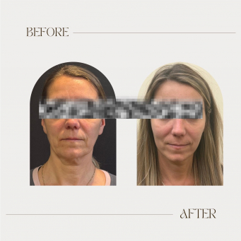 کلینیک لیزر و پوست