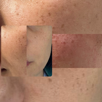 Laser and Skin Clinic