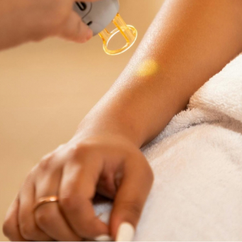 لیزر کل دست در کوکیتلام